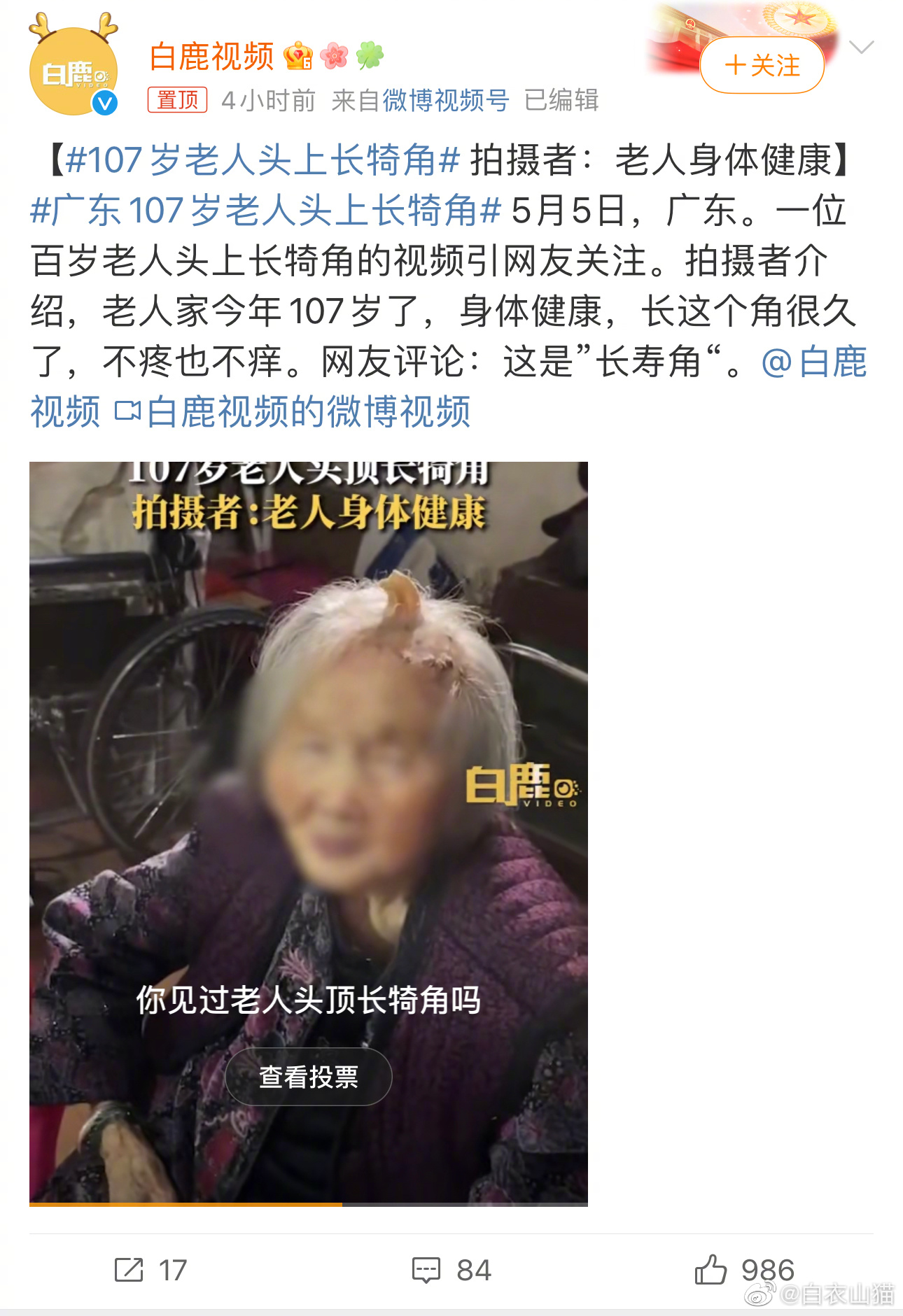 107岁老人头上长犄角