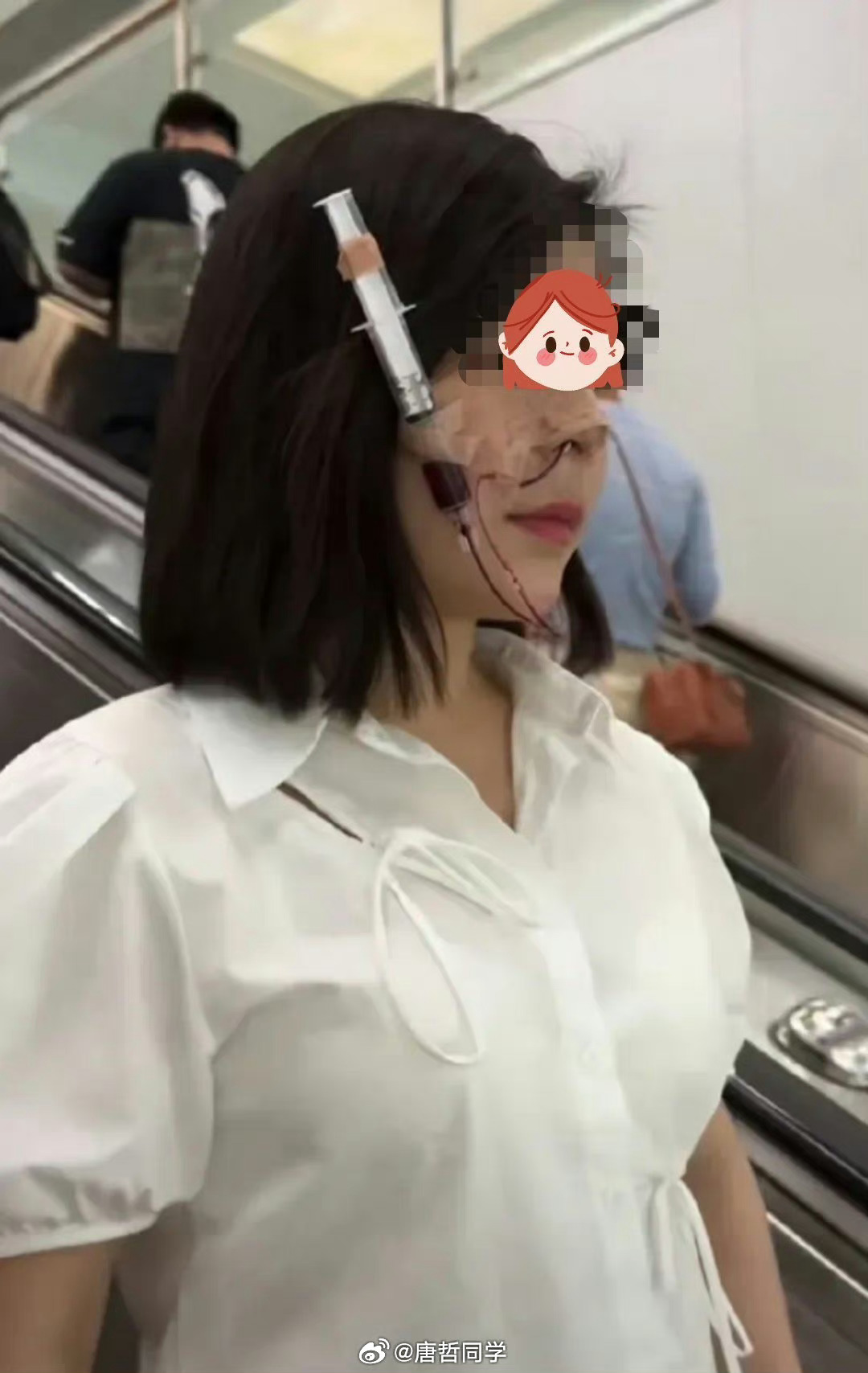 女子过海关双腿绑满少女针